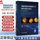 图解玻璃体视网膜手术操作要领与技巧 附手术视频 张少冲 张钊填 方冬 主编 参考书 眼科学 西医 9787117403016 人民卫生出版社