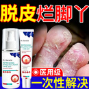 胖东来狼毒去i脚气脚臭止痒脱皮烂脚丫真菌感染喷剂乳膏代购同款 1盒装【三甲医科认证】20g+60ml