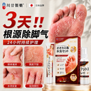川廿制药脚气喷雾剂软膏止痒脱皮烂脚丫真菌感染起小水泡痒根治脚气克星