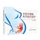 手把手图解电子胎心监护