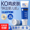 果酸VE尿素霜去鸡皮肤维生素e乳膏护手霜医用去黑滋润身体乳保湿 3支 150g【皮肤光滑 不见鸡皮】