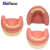 TWTCKYUS上颌窦提升操练模型 种植牙练习模型 口腔种植 软牙龈 齿科材料 上颌窦提升练习模型 1个