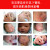 婴宝婴宝湿疹膏婴幼儿专用抑菌止瘙痒膏无激素3支装