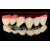 美国进口 粘结烤瓷牙粘合剂 同诊所款 牙齿套牙冠牙套假牙胶水牙科专用粘牙胶水粘结剂材料自己动手 粘牙套材料+工具