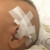 3M胶带敏感肌肤专用胶布1534-1宝宝婴儿童透气低敏纸胶 1534-1(5卷)