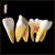 齿科材料 口腔器械器牙科材料义齿 全口牙 牙齿模型 标准模型 C款透明牙齿