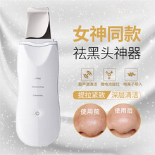 AKJ超声波铲皮机美容仪器去黑头脸部美肤仪器毛孔清洁器洁面神器家用 白色