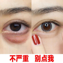 红参蜗牛多肽眼霜淡化黑眼圈淡化细纹脂肪粒眼袋男女提拉紧致补水保湿眼部精华比芭美 3瓶巩固装【淡化细纹去脂肪粒】