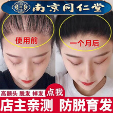 超市	
【买2送1】南京同仁堂防脱洗发水生姜育发头发增长液溢脂性脱发去油草本长发老姜王姜汁护发密发洗头水萃然 1瓶装【体验装，增发护发】