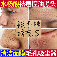 康雪水杨酸祛痘控油清洁面膜刷酸泥膜男女士去黑头闭口粉刺收缩毛孔果酸修护痘印痘坑 单瓶装（3瓶一疗程）