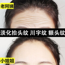 【抬头纹贴】皱纹额纹眉间贴去掉i皱纹去川字纹法令纹贴抗皱提拉紧致贴 三盒装30贴（抬头纹额护贴）