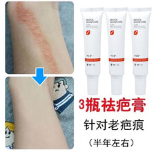 祛疤膏修复无痕去疤膏凹凸疤增生脸上老疤伤巴芦荟胶复平焕颜神器 三盒