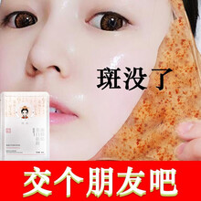 医后美白祛斑补水面膜女男祛斑产品去斑点淡化保湿斑水润修护肌肤提拉紧致 30片装176【周期装一片只要6块钱不到】