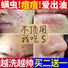 控油洗面奶男士女除螨虫氨基酸火山泥岩海盐深层去黑头角质油水杨酸痘印学生洗脸洁面乳泡沫慕斯套装水护嘉 祛痘除螨洗面奶单盒装【买两只可送一只，三只一周期】