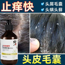 修正 去屑洗发水除螨控油平衡清爽滋润头螨虫头皮屑脂溢性头皮瘙痒草本植物止痒洗头膏洗发乳男女通用 三瓶周期装【中度者推荐】