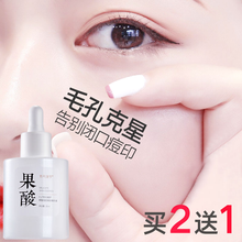 【美容院级别果酸】果酸换焕肤精华收缩毛孔精华液刷酸祛痘去淡化黑头闭口粉刺毛孔粗大水杨酸男女学生通用 【买2送1】35ml