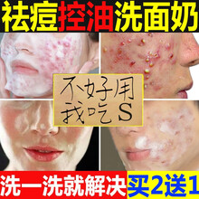 伊露莹祛痘控油洗面奶男士女士通用面部补水保湿抗痘印除螨虫细致毛孔深层清洁去黑头小样学生泡沫洁面乳 祛痘洁面乳