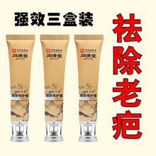 【老疤克星】去疤膏摔伤抓伤烫伤疤修复无痕手术疤妊娠纹增生疤痕 强效三支【去除老疤】80%人的选择
