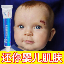 疤痕一抹消去疤痕倍舒痕祛疤膏去疤痕修复无痕美过疤克祛疤腿部 巩固疗程【全身无疤】