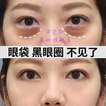 肌皙源红蛇毒眼膜淡化黑眼圈皱纹紧致抗皱西班牙进口类蛇毒肽胶原眼膜30对 红蛇毒眼膜单盒30对