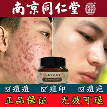 南京同仁堂祛痘膏痘印痘坑淡化痘疤痘印修复祛痘产品男女学生青春痘粉刺闭口芦荟草本凝胶魅魔 一盒体验装（祛痘舒缓）