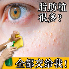 九叶草去脂肪粒眼霜眼部精华液去除油脂粒眼纹黑眼圈眼袋男女 1件【去脂粒，滋润眼部】